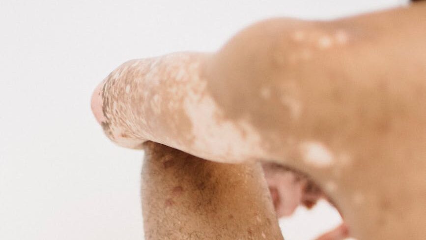 natural soap for psoriasis , crop ethnic man with blots on skin