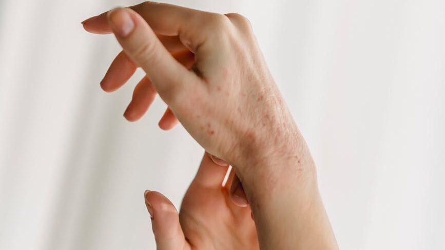 best soap for eczema hands of crop unrecognizable against white curtains